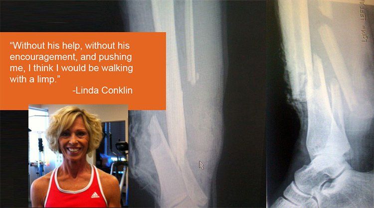 Patient Tale Traumatic Leg Injury Recuperation Linda’s Story Choose PT